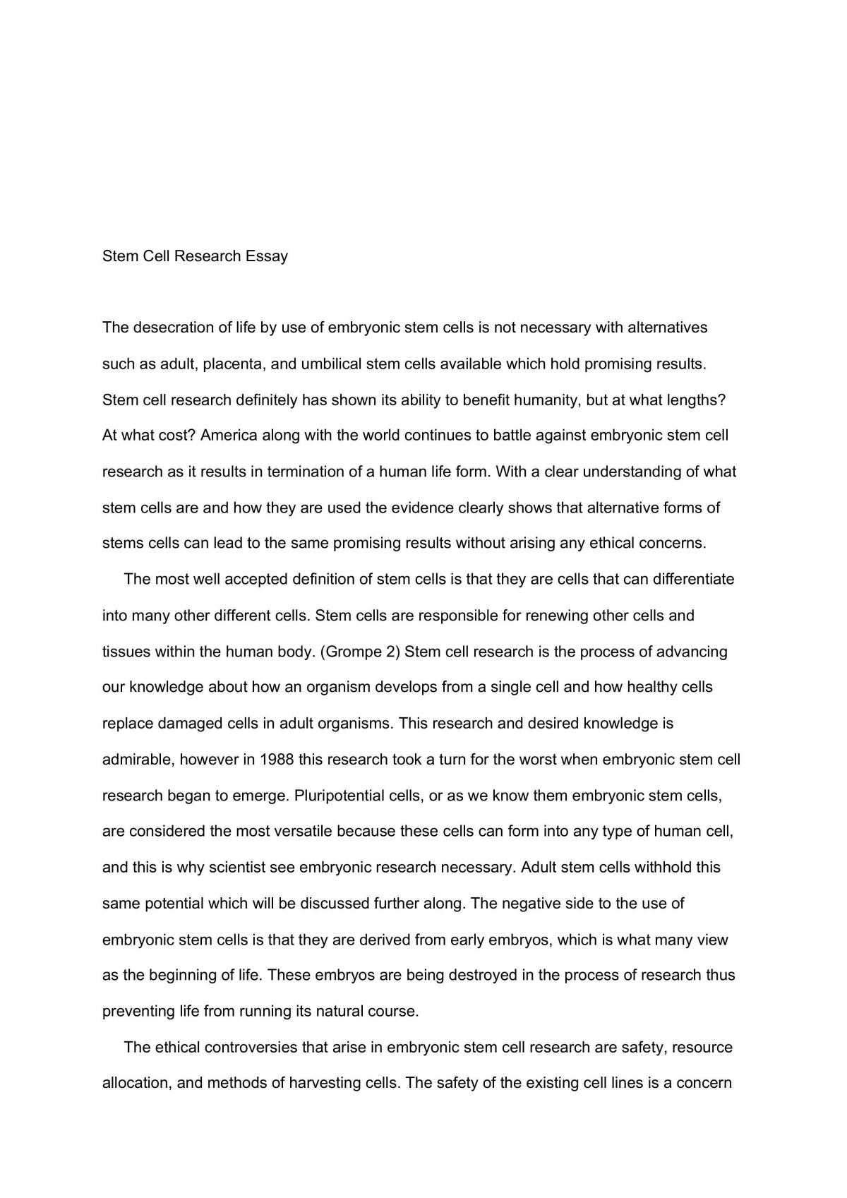 Why use Stem Cells? - Page 1