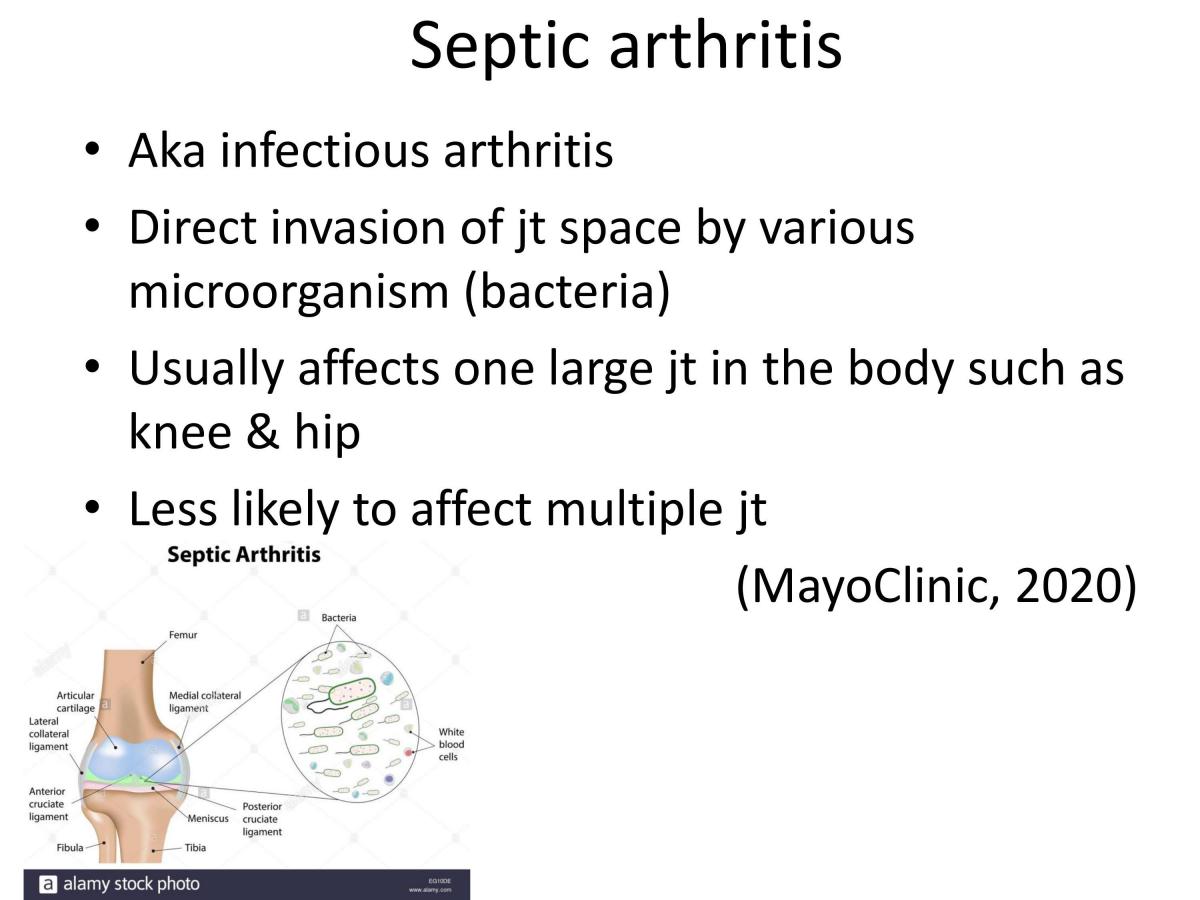 Septic Arthritis - Page 1