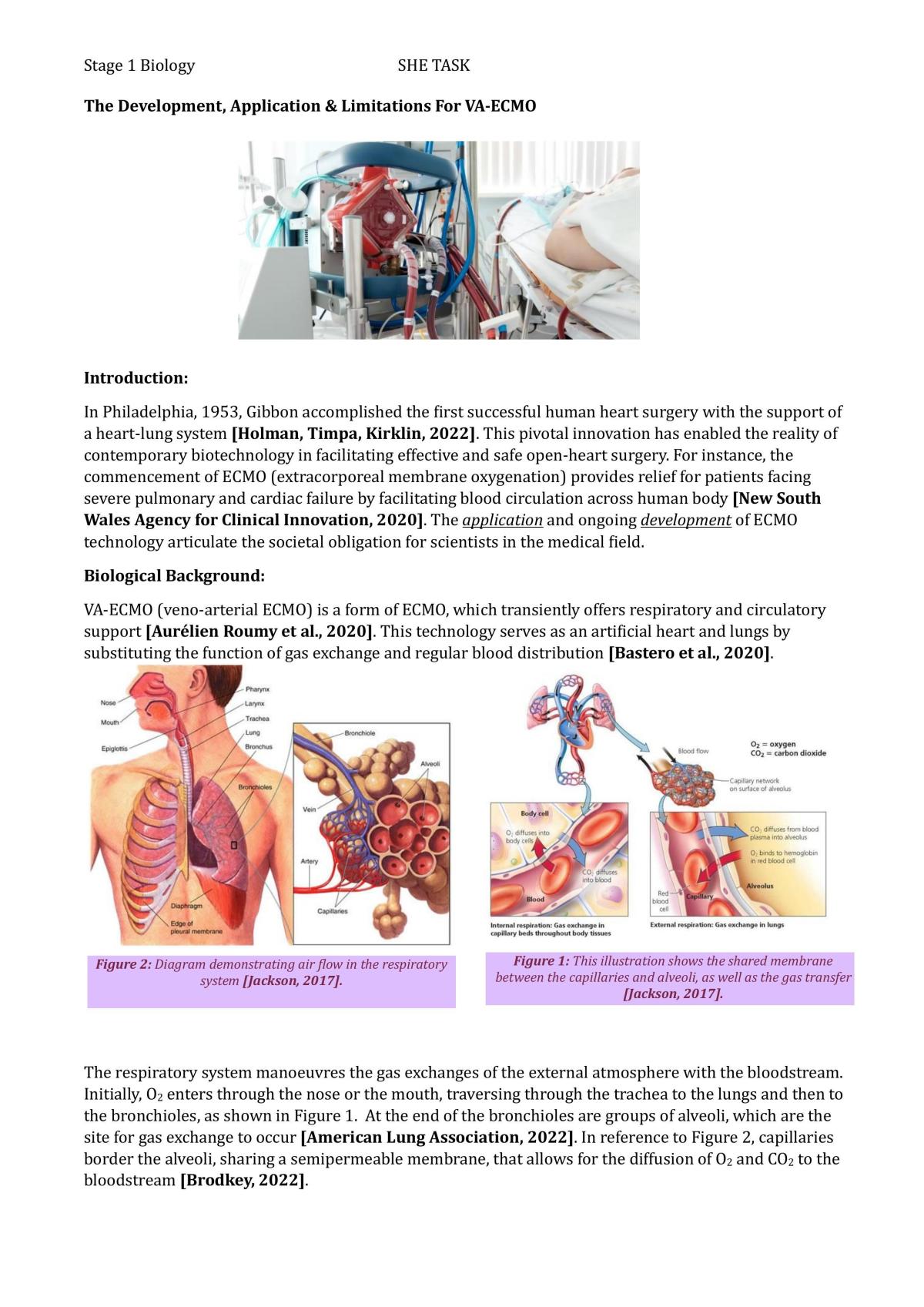 SHE TASK: Development, Application & Limitations for VA-ECMO - Page 1