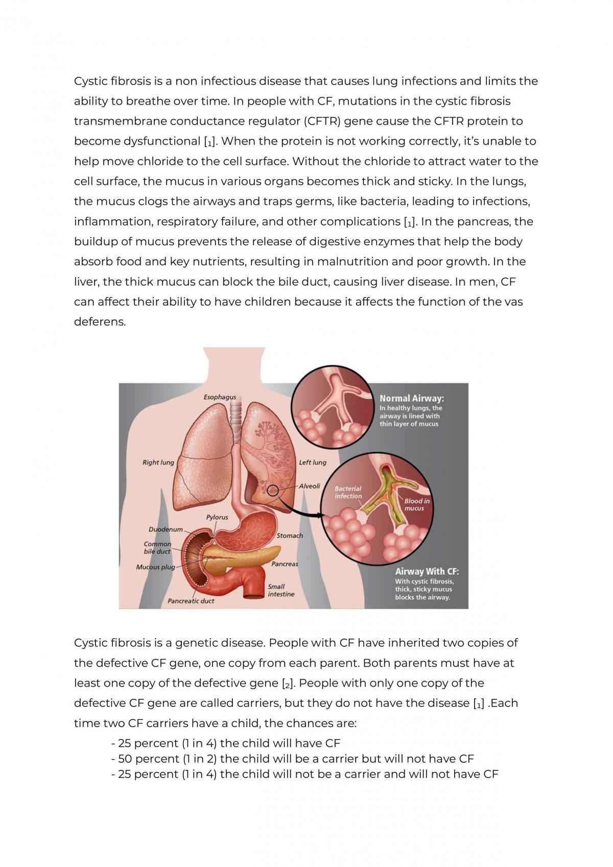 Реферат: Cystic Fibrosis Essay Research Paper Biology