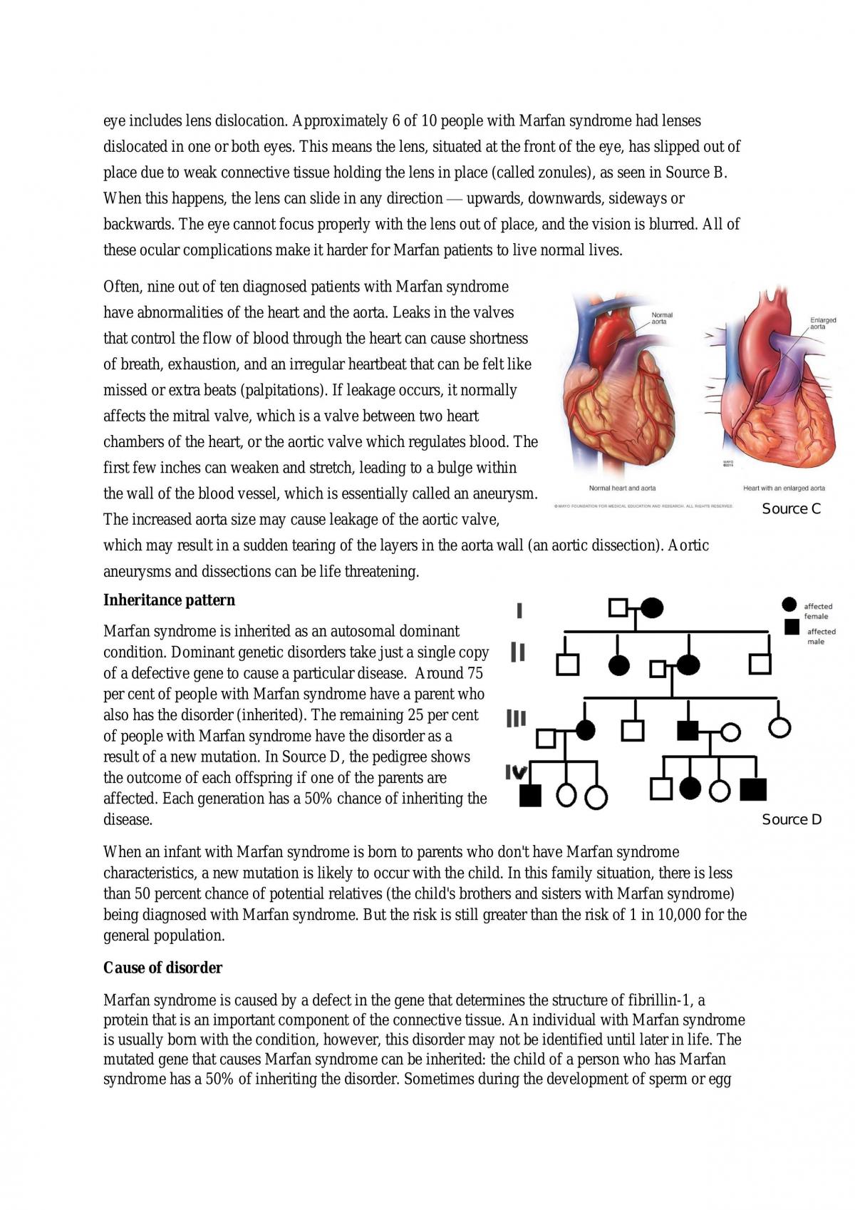 Marfan Syndrom Technology - Page 3