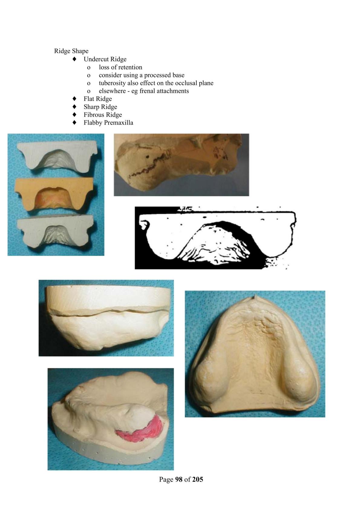 Operative Dentistry - Semester 1  - Page 97