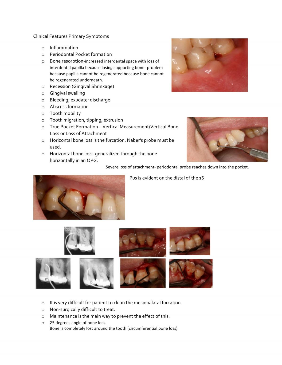 DEN2DPH Dentistry Public Health & Preventive Practice Notes - Page 42