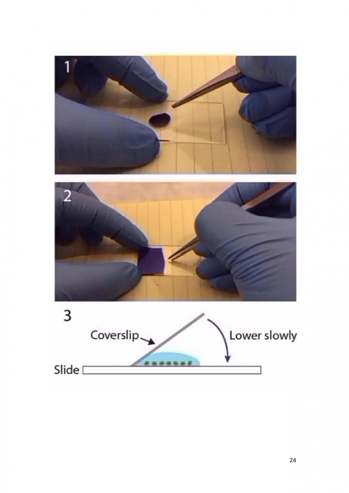 Histological Techniques Liver Cancer - Page 24